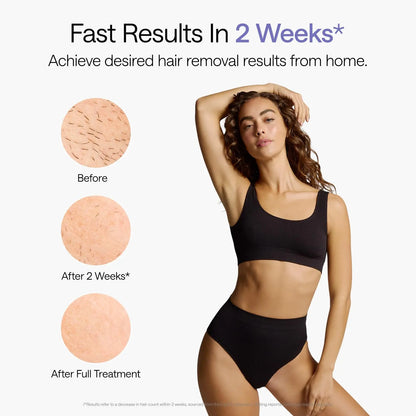 Air 10 IPL Hair Removal Device with Ice Cooling Technology – Permanent, Painless At-Home Treatments for Women and Men