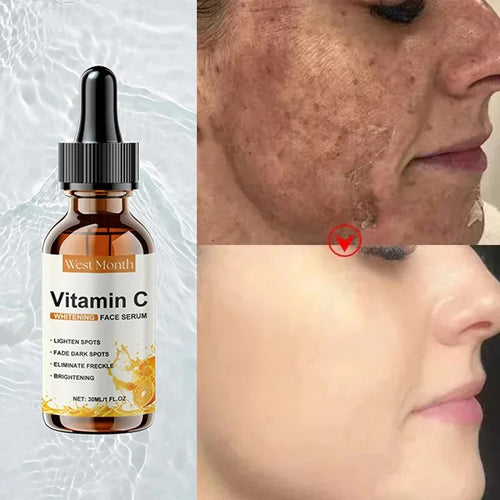 Vitamin C Whitening Freckles Facial Serum
