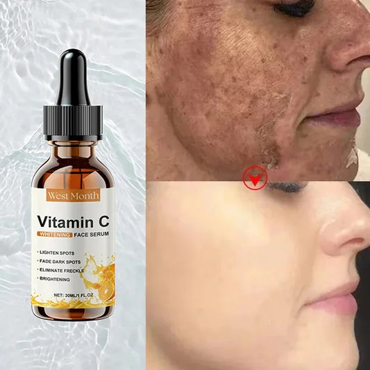 Vitamin C Whitening Freckles Facial Serum