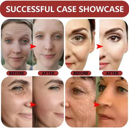 B3 Niacinamide Anti-Aging Serum