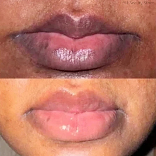 Dark Lip Repair Balm