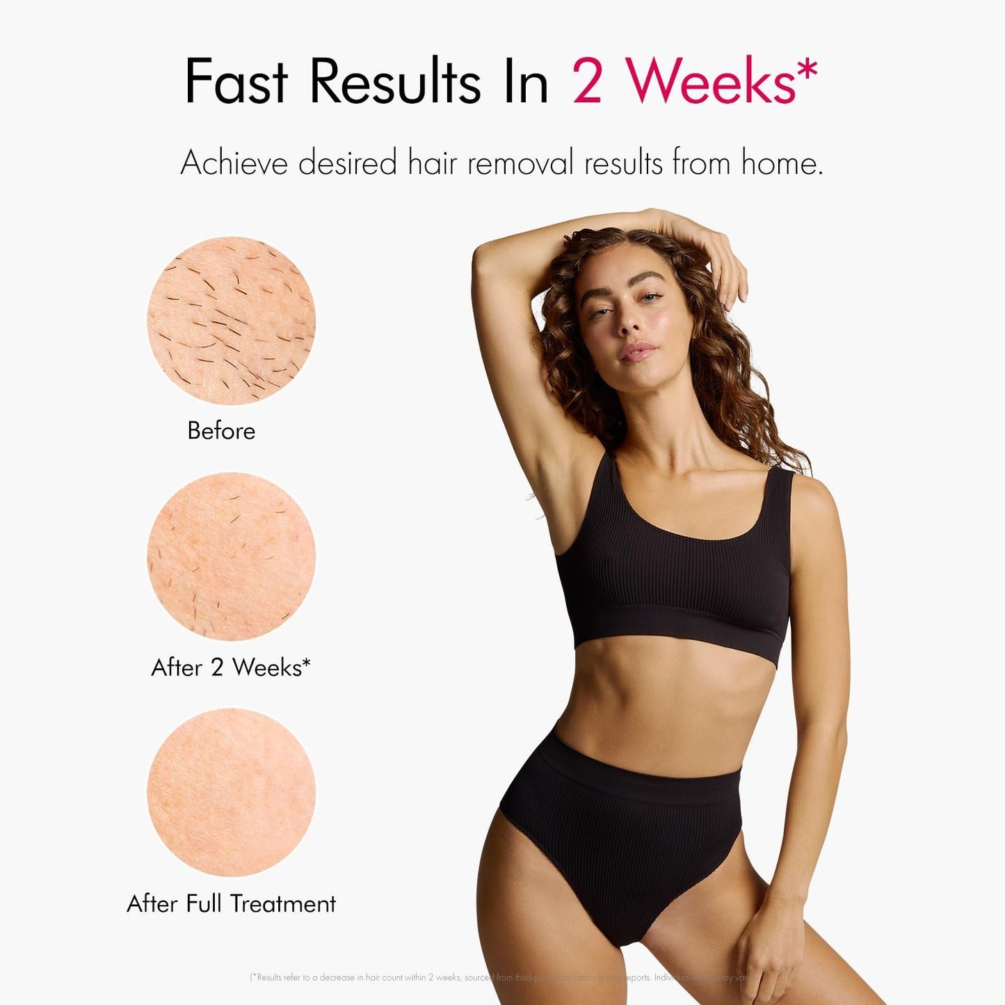 Air 10 IPL Hair Removal Device with Ice Cooling Technology – Permanent, Painless At-Home Treatments for Women and Men